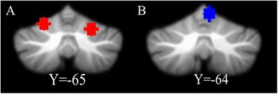 Intrinsic Cerebro-Cerebellar Functional Connectivity Reveals the Function of Cerebellum VI in Reading-Related Skills